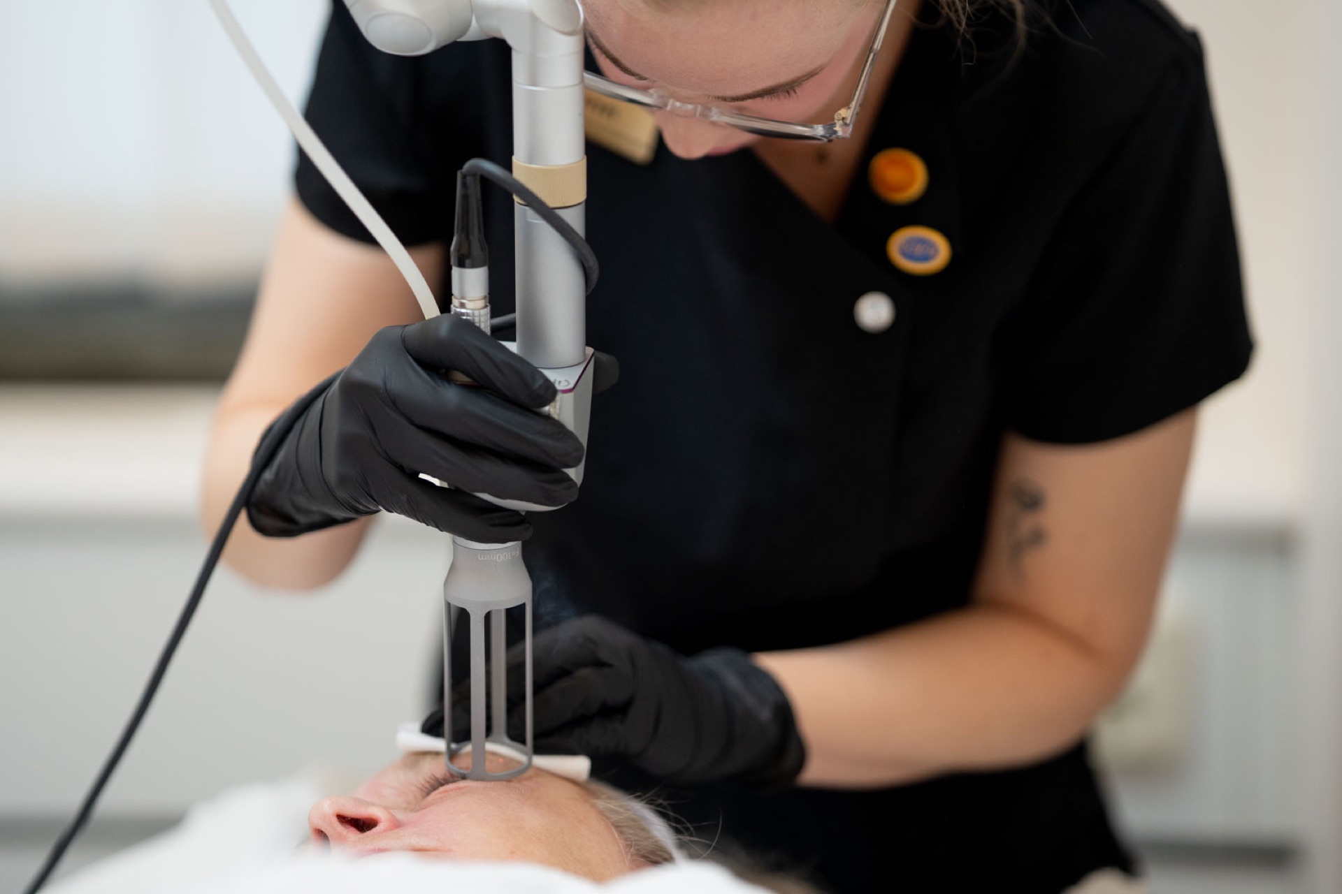 behandling med fraktionerad co2 laser | citylaser i Göteborg