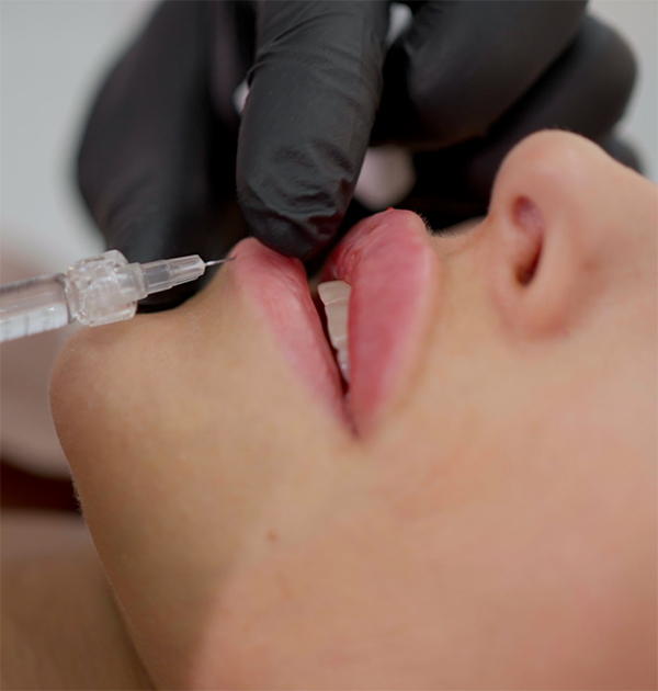 injektionsbehandling i Göteborg - Hos Citylaser®