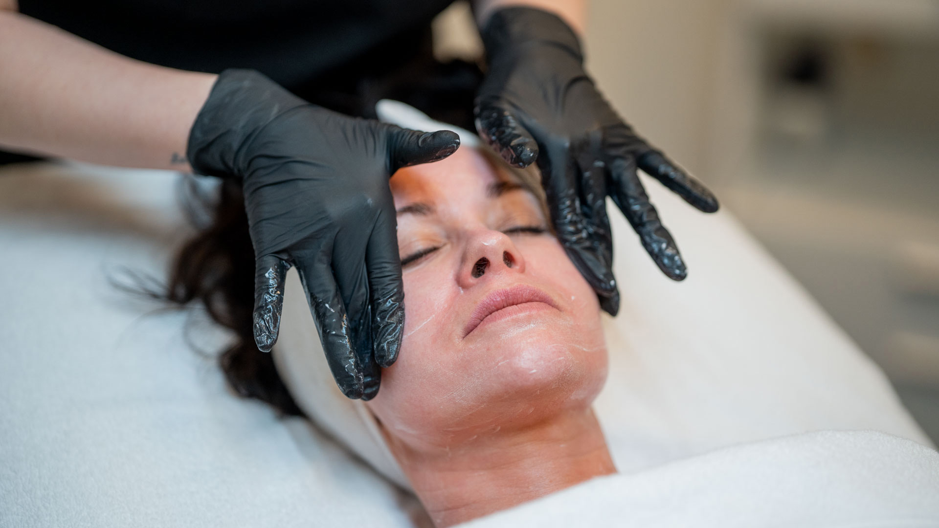 Milk peel göteborg | skonsan kemisk peeling med Dermaceutic