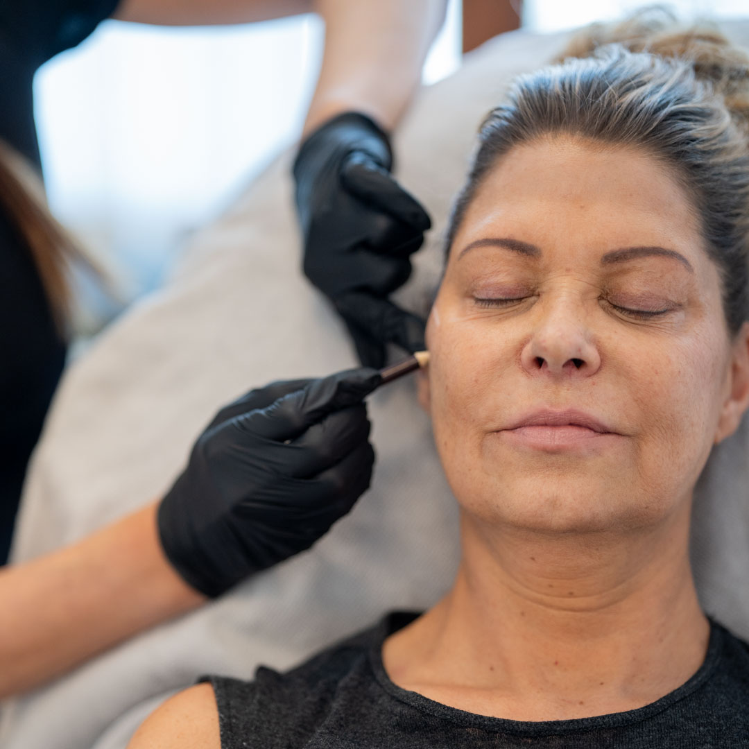 radiesse behandling som ökar volym med fillers